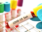 Bu virus pusuda bekliyor ve kalabal�klar endi�e veriyor!