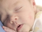 Bu Hastal�klar Bebe�inizin Kalbini Yoruyor!