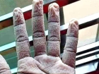 �apa'da g�revli doktorun elinin g�r�nt�s� sosyal medyada g�ndem oldu