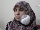 Çaresiz kadın yüzündeki dev kitleden kurtulmak için yardım bekliyor