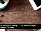 �in'de 11 Kalem Pili Midesinden ��kar�ld�