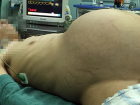 �inli Adam�n Karn�ndan 15 Kiloluk T�m�r ��kt�