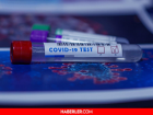 Covid testi sonucu ne zaman ��kar? 2022 Korona testi ne zaman belli olur?