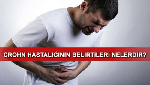 Crohn Hastal Nedir? Belirtileri Nelerdir?