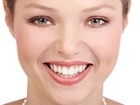 Di Beyazlatma (Bleaching)