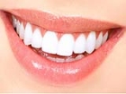 Di� �mplant� Nedir?