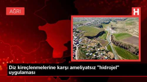 Diz Kirelenmesine Hidrojel Tedavisi