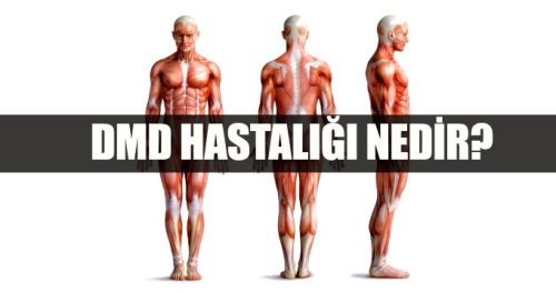 DMD hastal nedir? DMD belirtileri nelerdir? Tedavisi var m?