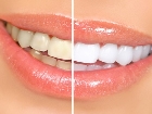Do�al Yollarla Di� Beyazlatmak M�mk�n