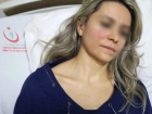Doktor, Mesai Çıkışı Aracına Binerken Bir Hasta Tarafından Darp Edildi