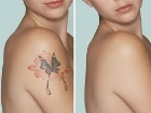 D�vme Sildirme Art�k Hi� Zor De�il!