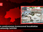 Down sendromunun kromozomal bozukluktan kaynakland belirtildi