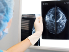 D�nya Kanser G�n� - Jingmei Li: Meme kanserini �nlemek i�in genetikten yararlanan doktor
