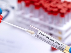 Dünya Sağlık Örgütü, düşük ve orta gelirli ülkelere 120 milyon koronavirüs hızlı test kiti sağlayacak