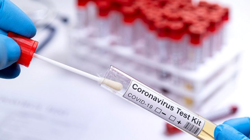 Dnya Salk rgt, dk ve orta gelirli lkelere 120 milyon koronavirs hzl test kiti salayacak