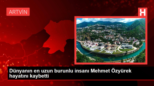 Dnyann en uzun burunlu insan Mehmet zyrek hayatn kaybetti