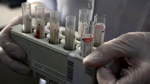 Dnyay yeni bir kresel salgn m bekliyor? ngiltere'de ortaya kan gizemli hepatit virs Avrupa ve ABD'de grld
