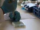 ELISA testi ile hem koronavirus hem de antikorlar� daha �abuk tespit edilebilecek