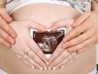 En B�y�k Mucize: Do�um