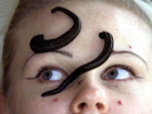 En �yi Bilinen Alternatif T�p Y�ntemleri