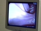 Endoskopik Ultrasonografi, Pankreasta Detayl� G�r�nt�leme Sa�layacak