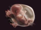 Epidural Anestezi Nedir?