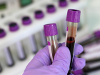 Ferritin nedir? Ferritin eksikli�i nedir?
