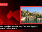 Gaziantep Hastanesi'nden Yeni Gelitirilen Bypass Yntemi
