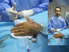 Gelece�in Anjiografi Tekni�i, Ege �niversitesi T�rkiye'de Uyguland�