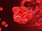 Gen tedavisiyle hemofilide yeni bir d�nem ba�layacak!