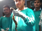 Gen Kzn Midesinden Bir nsan Boyunda Kl Yuma kt