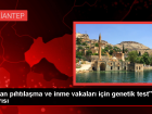 Genetik Test Yapt�rmayanlar Emboli Riski Alt�nda