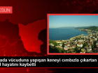 Giresun'da Keneye Ba�l� KKKA Hastal���ndan �len Gen� K�z