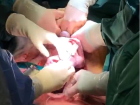 Göbek kordonu kesilmeden ameliyat edilen bebek, sağlıklı şekilde dünyaya geldi