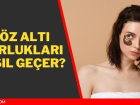 G�z alt� morluklar� nas�l ge�er? G�z alt� kararmas�na ne iyi gelir? G�z alt� morluklar� i�in ne yap�l�r?
