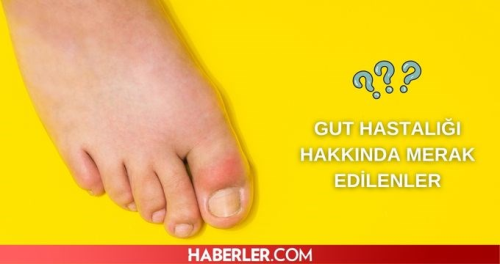 Gut hastal nedir? Gut hastalnn belirtileri ve tedavisi nedir?