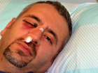Hasta Yak�n� Sa�l�k Teknikerine Sald�rd�, 2 Y�l 3 Ay Hapis Cezas� Ald�