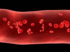 Hemofili-A Hastalar�na �yi Haber
