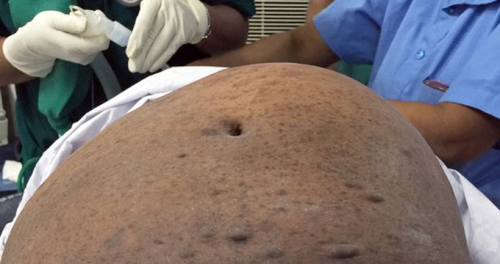 Hindistanl Kadnn Karnndan 7 Kg Arlnda Tmr karld