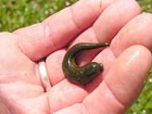 Hirudoterapi