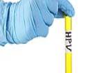 HPV Testi Nedir?