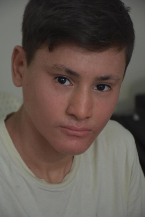 ktiyozis Hastas Kayra'nn Gnele mtihan