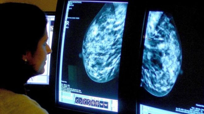 İngiltere: Kanserli Hastaların Ömrü Kat Kat Uzadı