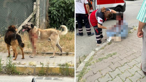 stanbul'da kpek saldrsna urayan kadn gzn kaybetti