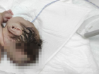 Kahramanmara�'ta beyni kafatas�ndan d��ar�da olan bebek do�du
