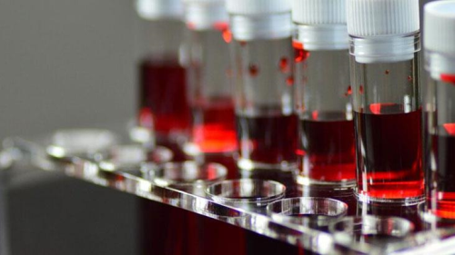 Kan gruplar�yla ilgili korkutan ara�t�rma! Aralar�ndan biri felaket hastal��a kar�� �ok diren�siz