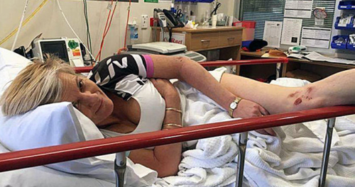 Kanguru Sald�r�s�na Maruz Kalan Kad�n�n G���sleri Patlad�