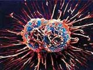 Kanser �nsan Yap�m� ��kt�!