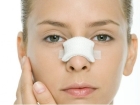 Kapal� Rinoplasti Nedir ? - Op. Dr. Mazhar �elikoyar