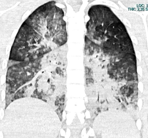 Karadeniz'de Bo�ulma Vakalar� Art�yor